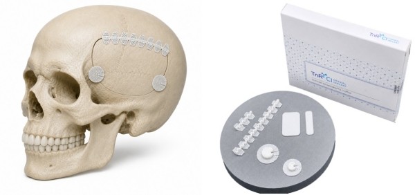 티앤알바이오팹, 3D 프린팅 두개골 임플란트 美 FDA 510(k) 허가 획득