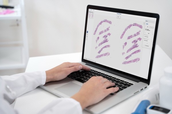 엠티에스컴퍼니, AI 병리 진단보조 'Ai-Alpa Mitosis' 2등급 제조인증